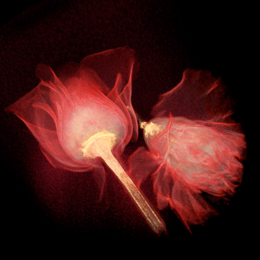Rose and Carnation CT scan